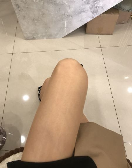 肺结节